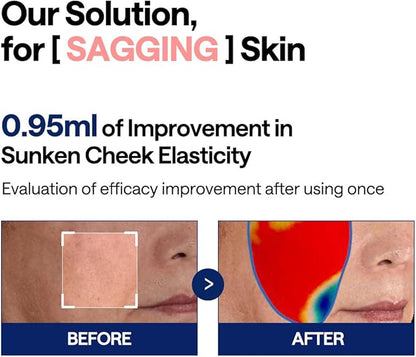 Advertisement for a skincare solution showing before and after effects on sunken cheek elasticity at Zibuya